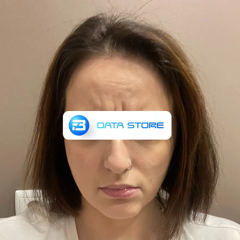 Angry Facial Expression image dataset sample from Caucasian People